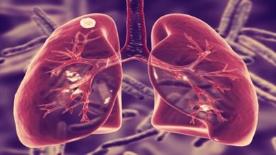 روسيا.. بكتيريا جديدة تساعد على علاج مرض السل المقاوم للأدوية