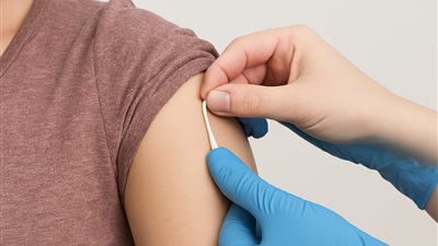  وسيلة منع الحمل عن طريق شريحة تغرس في الذراع