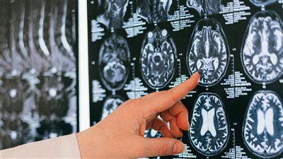 دراسة جديدة لا تفوق لنصف الدماغ على الآخر في التفكير