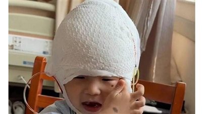 معاناة طفل تعرض للتنمر بلقب ميكي ماوس