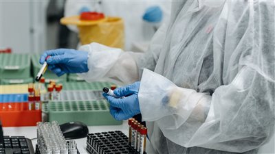 تحذيرات صحية عالمية من استمرار ظهور بؤر أمراض معدية مع دعوات لتعزيز المراقبة والاستجابة السريعة