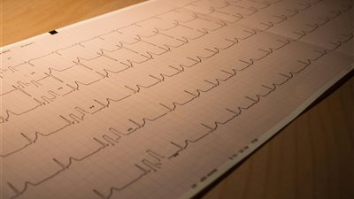 دراسة حديثة: أنماط النوم غير المنتظمة ترتبط بزيادة خطر الإصابة بأمراض القلب