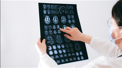 مراكز بحثية تكشف عن تقنية جديدة لاستهداف الدماغ باستخدام الموجات فوق الصوتية لتسهيل العلاج