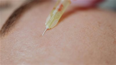 الإمارات تطلق أول تجربة سريرية لعلاج سرطان الجلد باستخدام إبر دقيقة تحمل دوكسوروبيسين